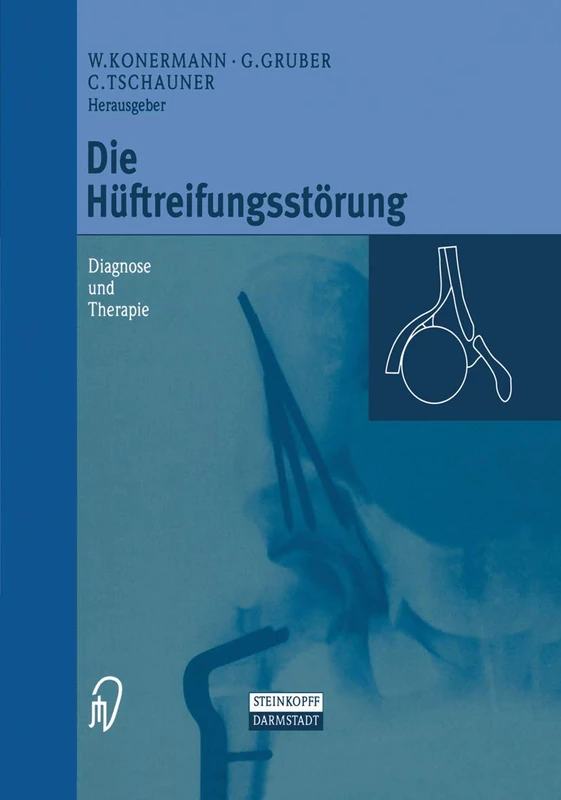 Die Huftreifungsstorung
