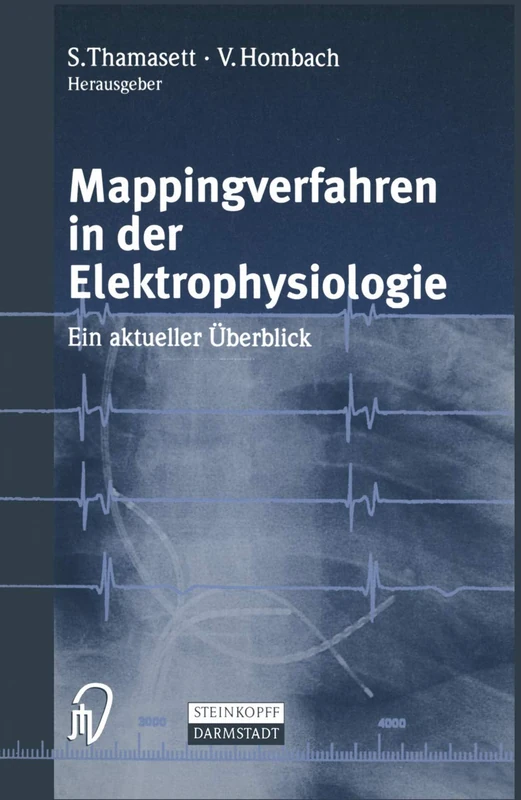 Mappingverfahren in der Elektrophysiologie: Ein aktueller Überblick - Image 1