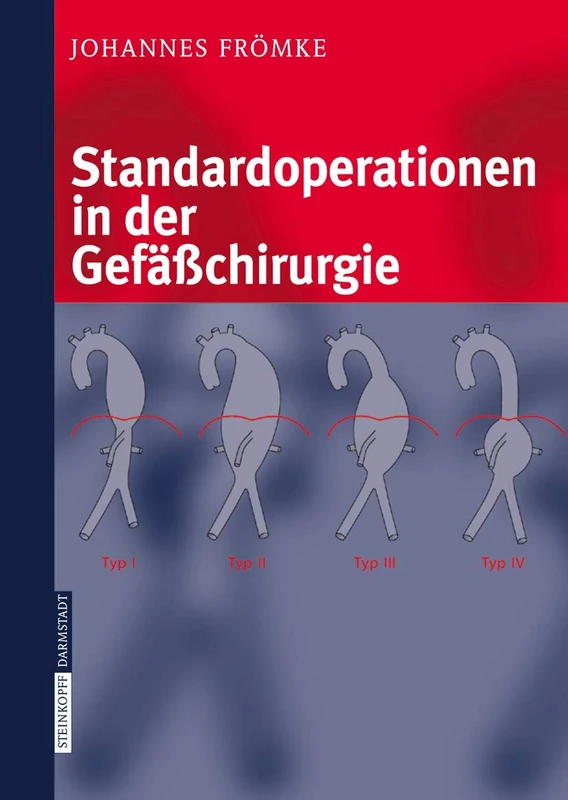 Standardoperationen in der Gefäßchirurgie