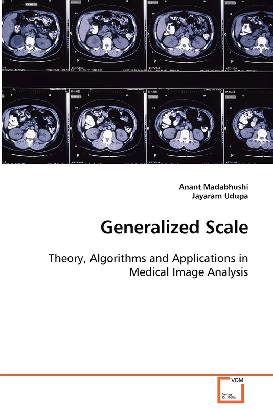 Generalized Scale