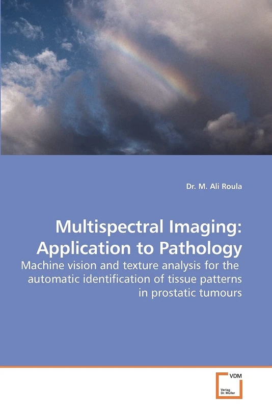 Multispectral Imaging: Application to Pathology: Machine vision and texture analysis for the automatic identification of tissue patterns in prostatic tumours