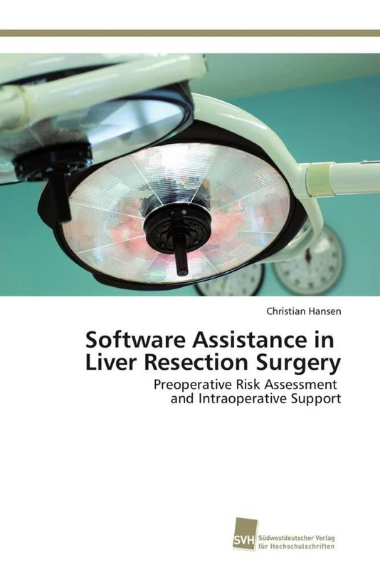 Software Assistance in Liver Resection Surgery: Preoperative Risk Assessment and Intraoperative Support