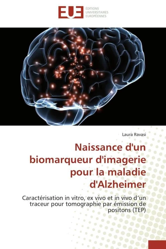 Naissance d'un biomarqueur d'imagerie pour la maladie d'Alzheimer: Caractérisation in vitro, ex vivo et in vivo d’un traceur pour tomographie par émission de positons (TEP) - Image 1