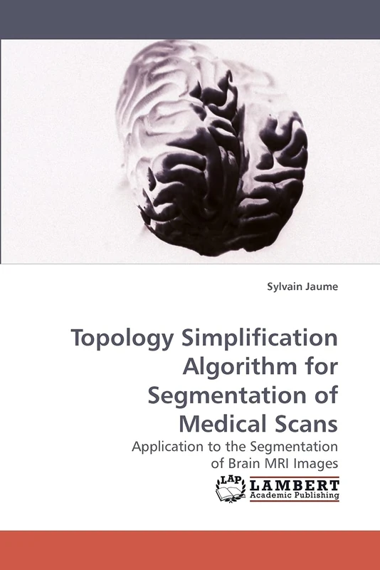 Topology Simplification Algorithm for Segmentation of Medical Scans: Application to the Segmentation of Brain MRI Images