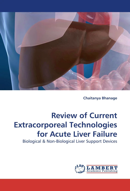 Review of Current Extracorporeal Technologies for Acute Liver Failure: Biological: Biological & Non-Biological Liver Support Devices - Image 1