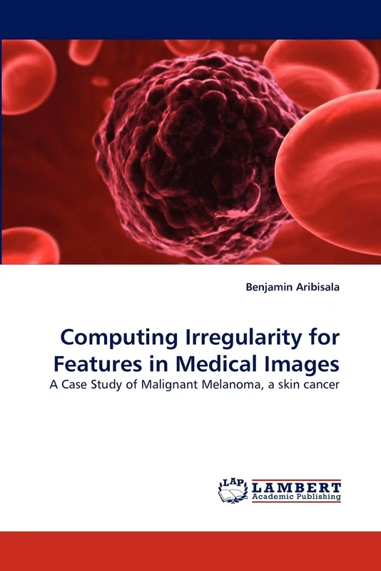 Computing Irregularity for Features in Medical Images: A Case Study of Malignant Melanoma, a skin cancer
