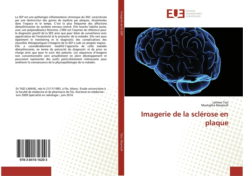 Imagerie de la sclérose en plaque - Image 1