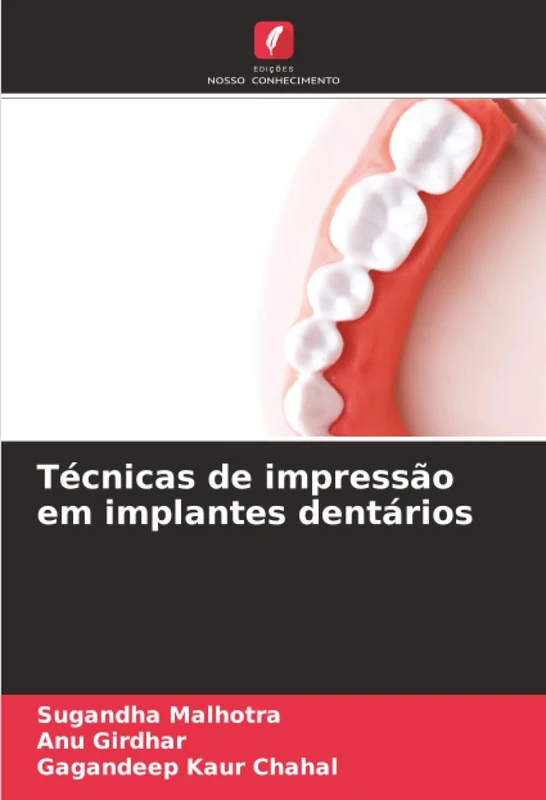 Técnicas de impressão em implantes dentários
