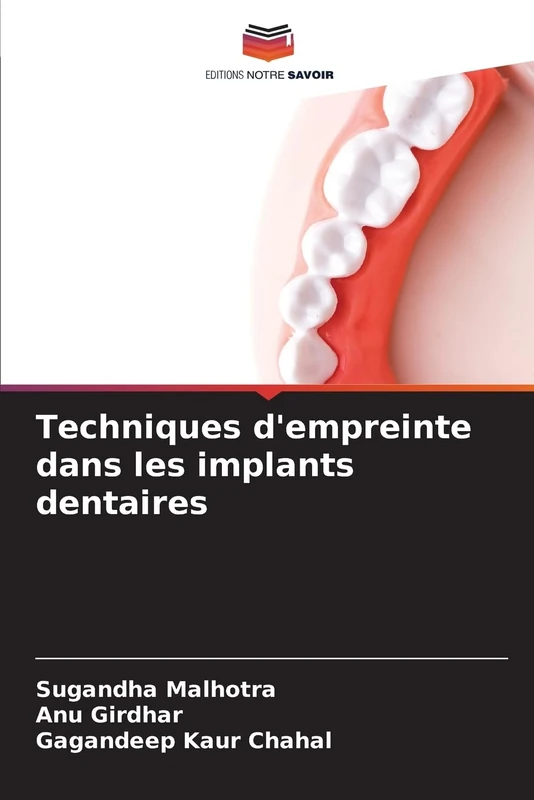 Techniques d'empreinte dans les implants dentaires - Image 1