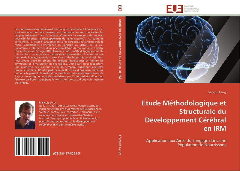 Etude Méthodologique et Structurale du Développement Cérébral en IRM: Application aux Aires du Langage dans une Population de Nourrissons (Omn.Univ.Europ.) - Image 1