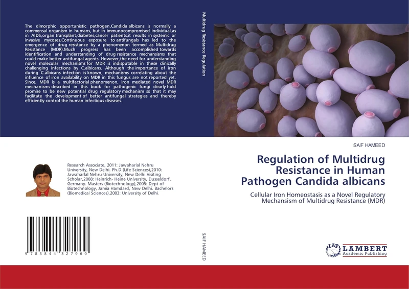 Regulation of Multidrug Resistance in Human Pathogen Candida albicans: Cellular Iron Homeostasis as a Novel Regulatory Mechansism of Multidrug Resistance (MDR) - Image 1