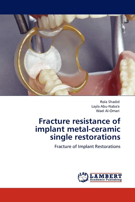Fracture resistance of implant metal-ceramic single restorations: Fracture of Implant Restorations