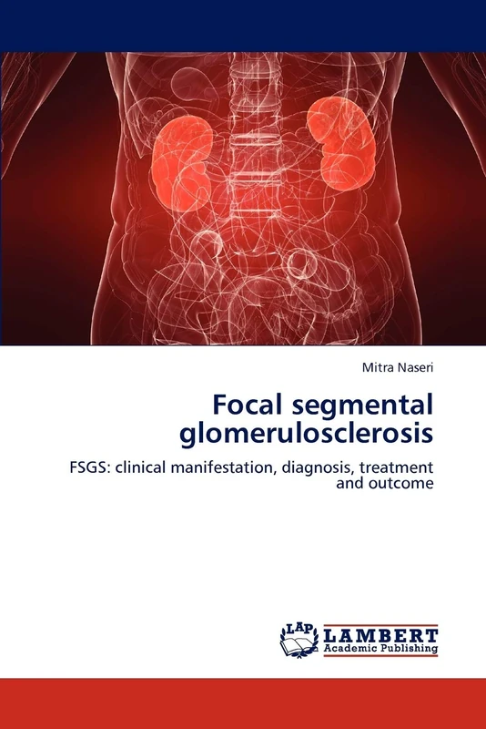 Focal segmental glomerulosclerosis: FSGS: clinical manifestation, diagnosis, treatment and outcome - Image 1