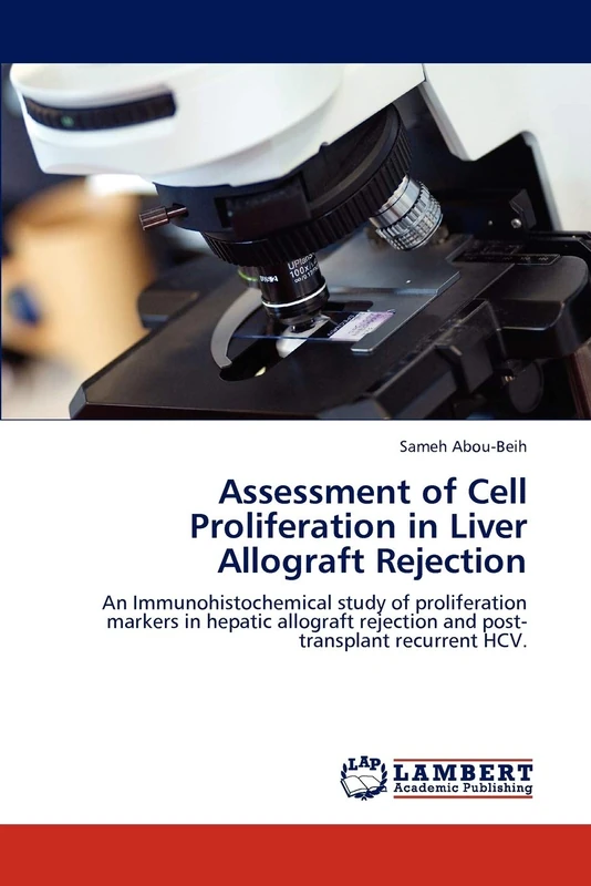 Assessment of Cell Proliferation in Liver Allograft Rejection: An Immunohistochemical study of proliferation markers in hepatic allograft rejection and post-transplant recurrent HCV.