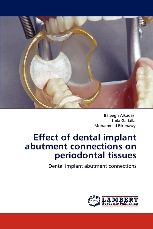 Effect of dental implant abutment connections on periodontal tissues: Dental implant abutment connections