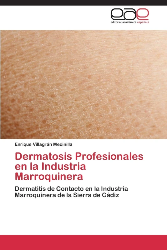 Dermatosis Profesionales en la Industria Marroquinera: Dermatitis de Contacto en la Industria Marroquinera de la Sierra de Cádiz