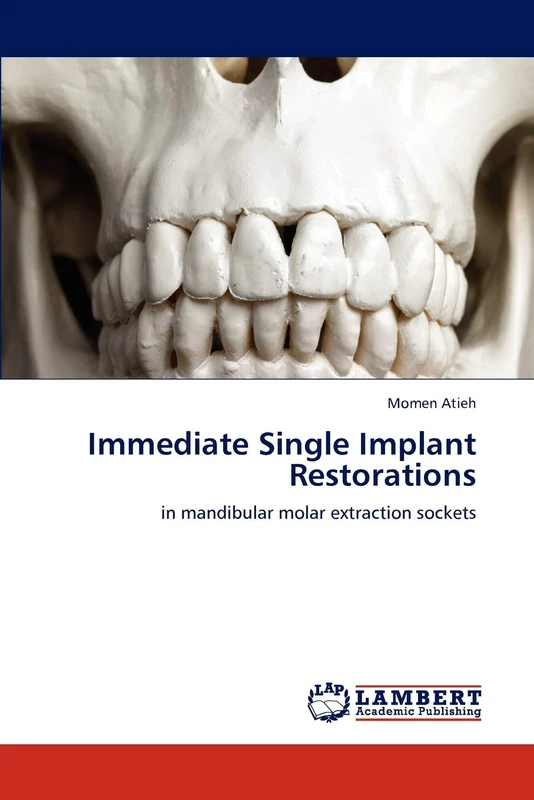 Immediate Single Implant Restorations: in mandibular molar extraction sockets