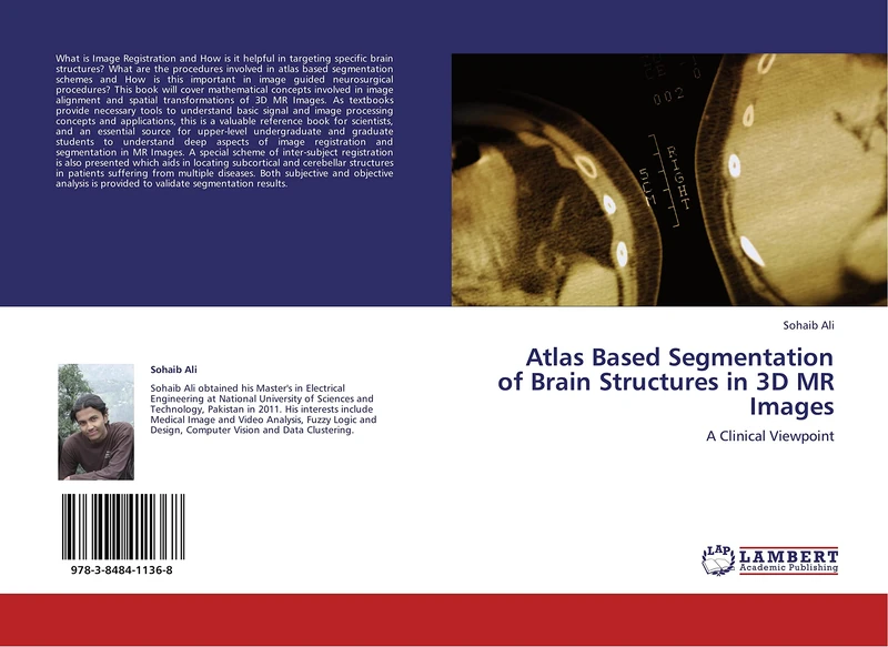 Atlas Based Segmentation of Brain Structures in 3D MR Images: A Clinical Viewpoint