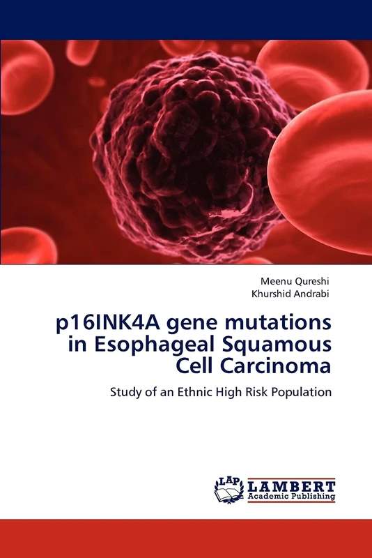 p16INK4A gene mutations in Esophageal Squamous Cell Carcinoma: Study of an Ethnic High Risk Population - Image 1
