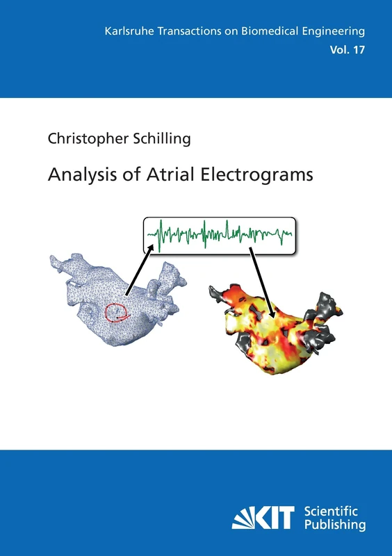 Analysis of Atrial Electrograms (Karlsruhe transactions on biomedical engineering) - Image 1