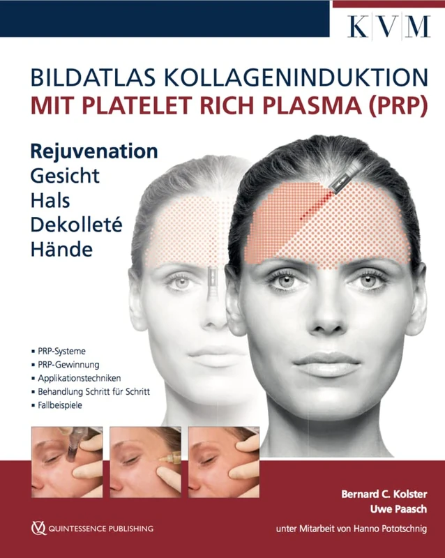 KVM Bildatlas Kollageninduktion mit PRP - Rejuvenation Guide