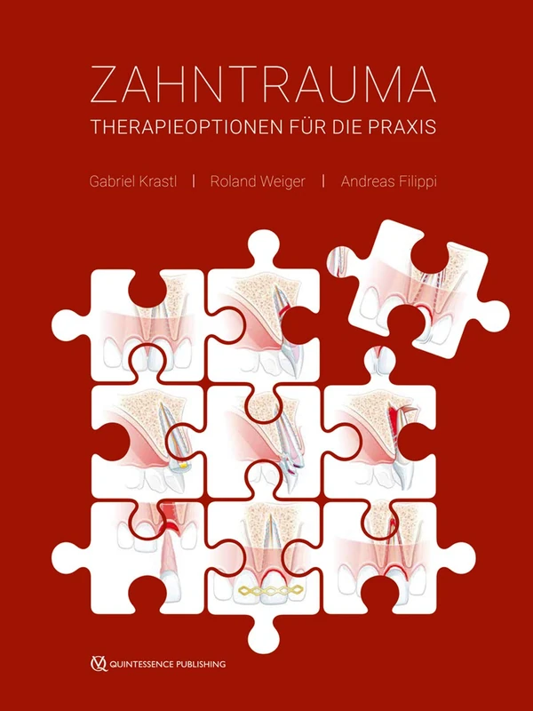 Zahntrauma: Therapieoptionen für die Praxis