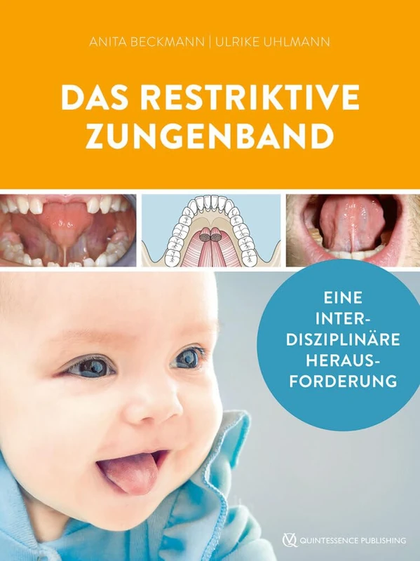 Das restriktive Zungenband: Eine interdisziplinäre Herausforderung - Image 1