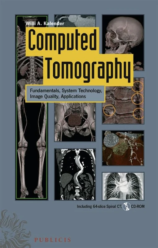 Computed Tomography: Fundamentals, System Technology, Image Quality, Applications