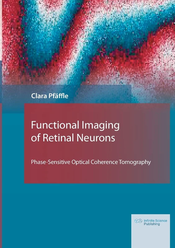 Functional Imaging of Retinal Neurons: Phase-Sensitive Optical Coherence Tomography - Image 1
