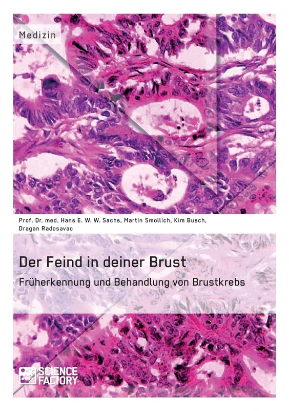 Der Feind in deiner Brust. Früherkennung und Behandlung von Brustkrebs - Image 1
