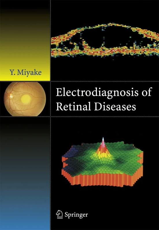 Electrodiagnosis of Retinal Disease - Springer Medical Book