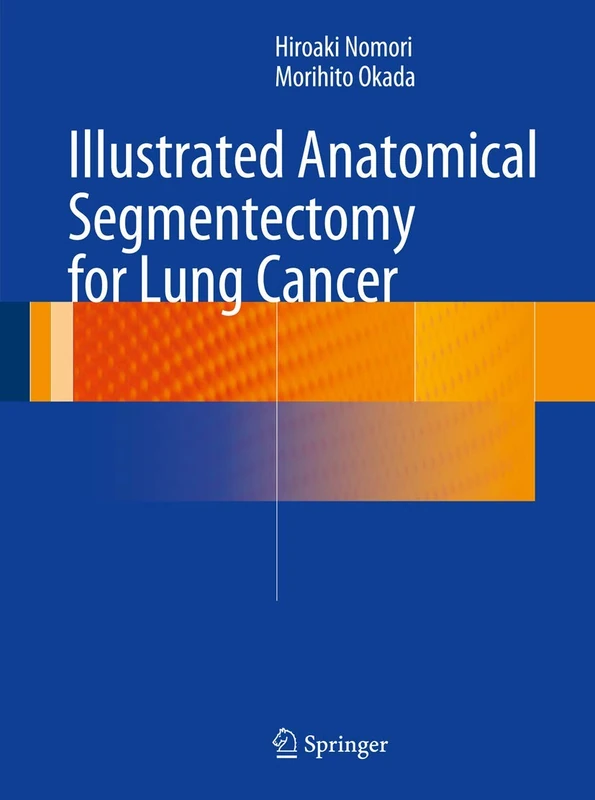 Springer Illustrated Anatomical Segmentectomy for Lung Cancer