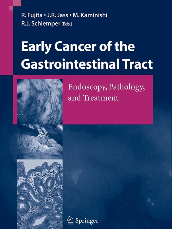 Early Cancer of the Gastrointestinal Tract: Endoscopy, Pathology, and Treatment
