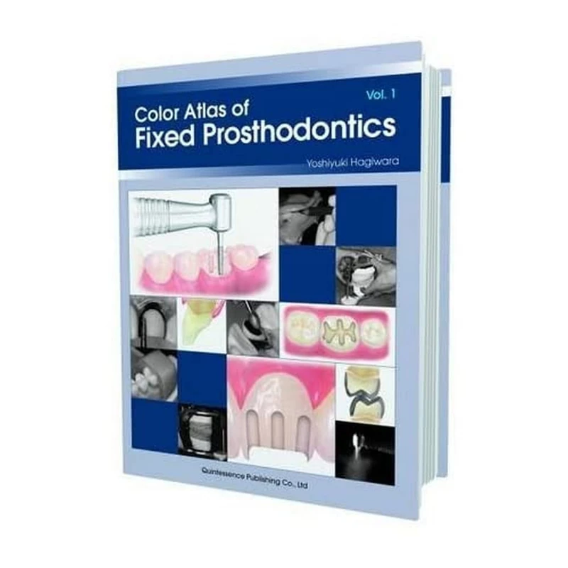 Color Atlas of Fixed Prosthodontics: Vol 1