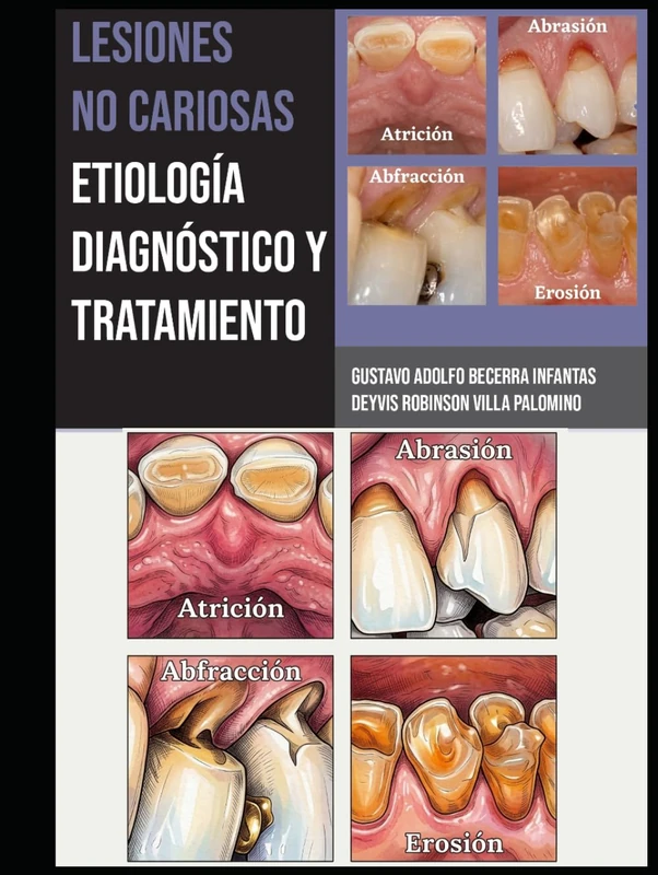 Lesiones no cariosas: etiología, diagnóstico y tratamiento