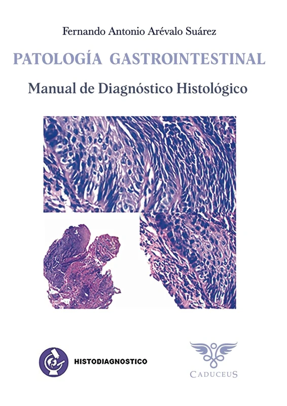 Histodiagnostico: Patologia Gastrointestinal - Caduceus