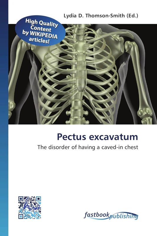 Pectus excavatum: The disorder of having a caved-in chest - Image 1