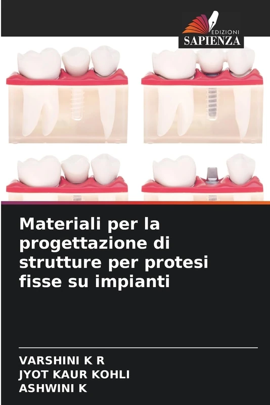 Materiali per la progettazione di strutture per protesi fisse su impianti