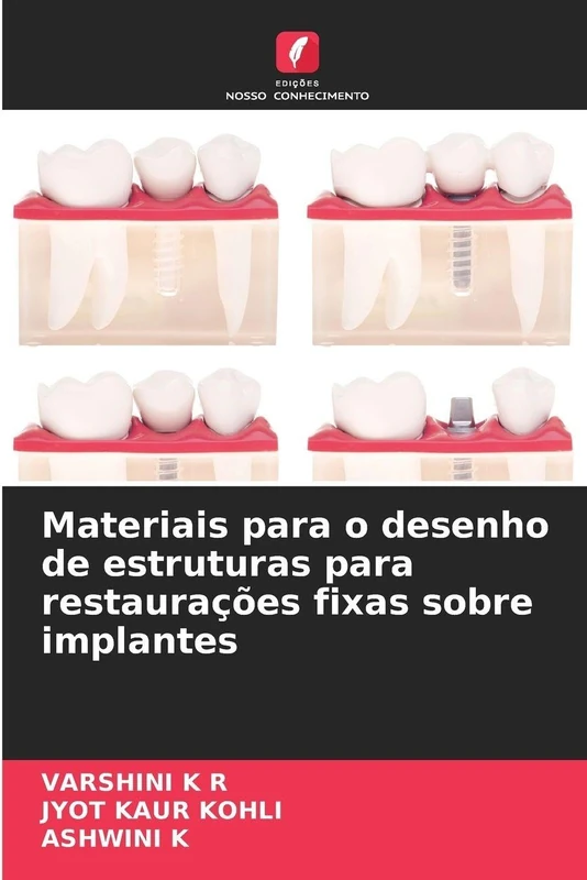 Materiais para o desenho de estruturas para restaurações fixas sobre implantes