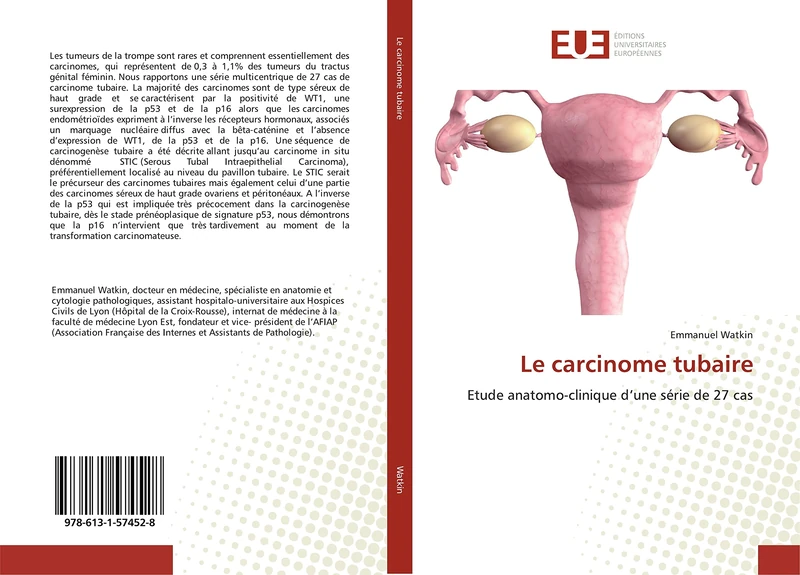 Le carcinome tubaire: Etude anatomo-clinique d’une série de 27 cas (Omn.Univ.Europ.)
