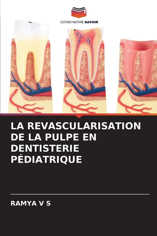 La Revascularisation de la Pulpe En Dentisterie Pédiatrique
