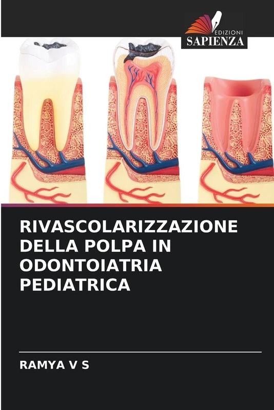 Rivascolarizzazione Della Polpa in Odontoiatria Pediatrica