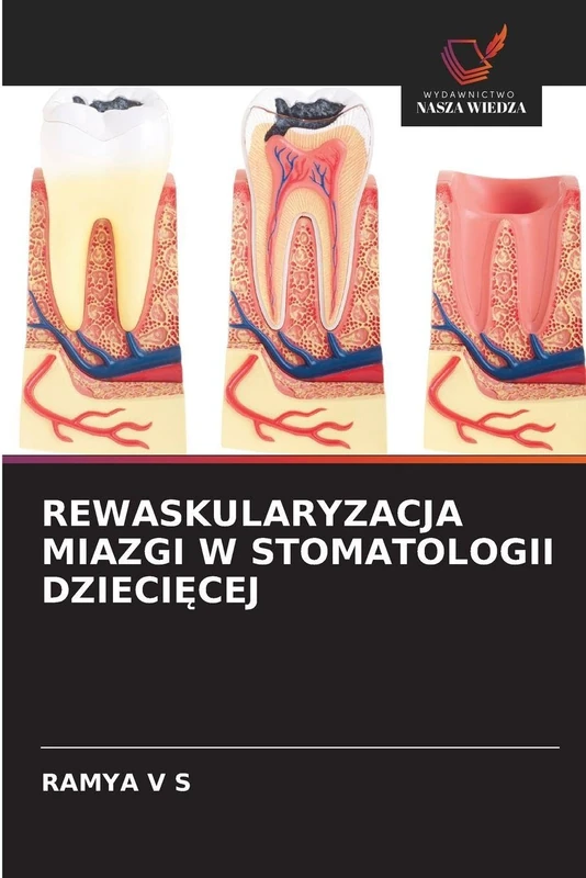 Rewaskularyzacja Miazgi W Stomatologii DzieciĘcej