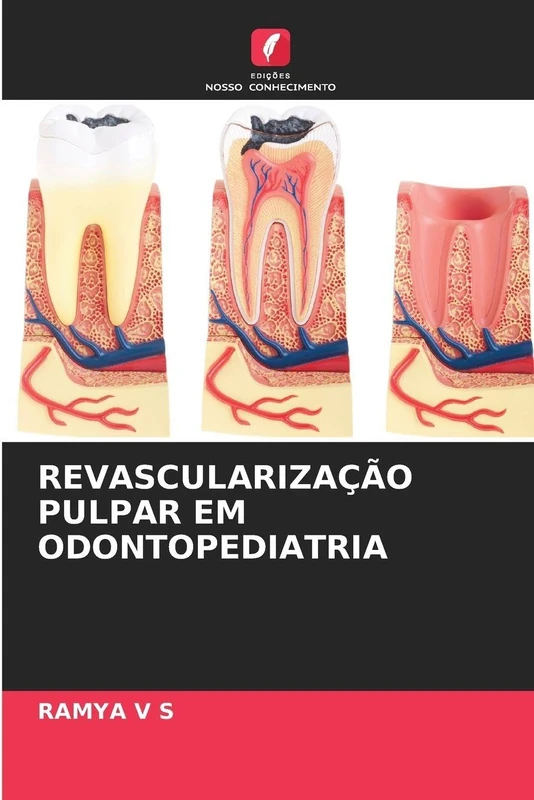 Revascularização Pulpar Em Odontopediatria