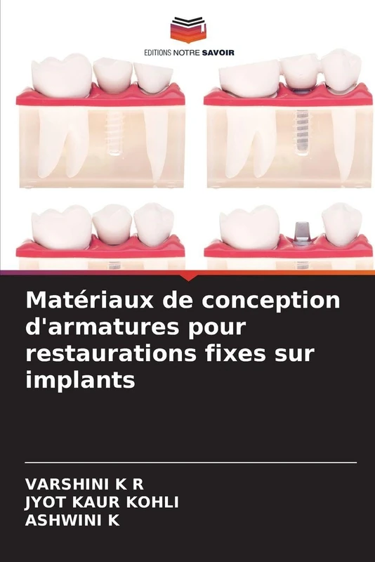 Matériaux de conception d'armatures pour restaurations fixes sur implants