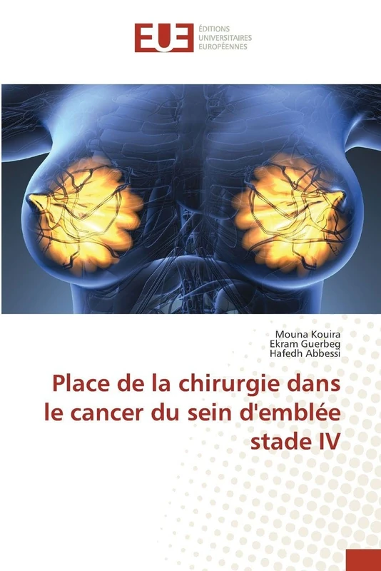 Place de la chirurgie dans le cancer du sein d'emblée stade IV - Image 1