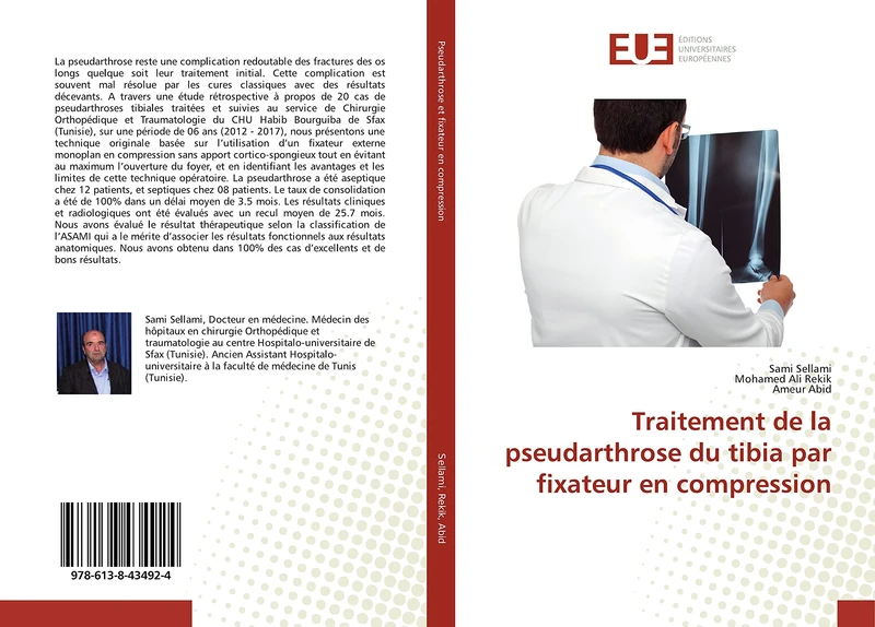 Traitement de la pseudarthrose du tibia par fixateur en compression - Image 1