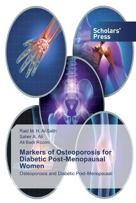 Markers of Osteoporosis for Diabetic Post-Menopausal Women - Image 1