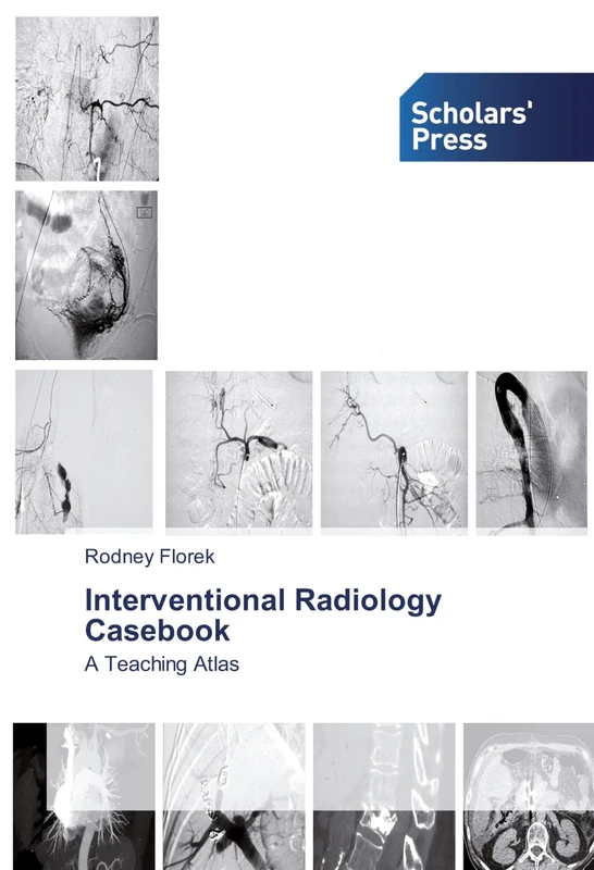 Interventional Radiology Casebook: A Teaching Atlas - Image 1