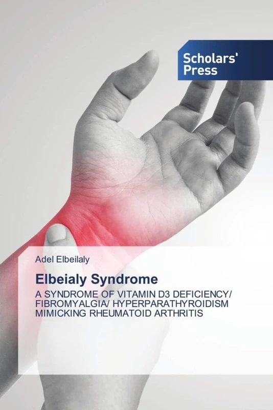 Elbeialy Syndrome: A SYNDROME OF VITAMIN D3 DEFICIENCY/ FIBROMYALGIA/ HYPERPARATHYROIDISM MIMICKING RHEUMATOID ARTHRITIS - Image 1